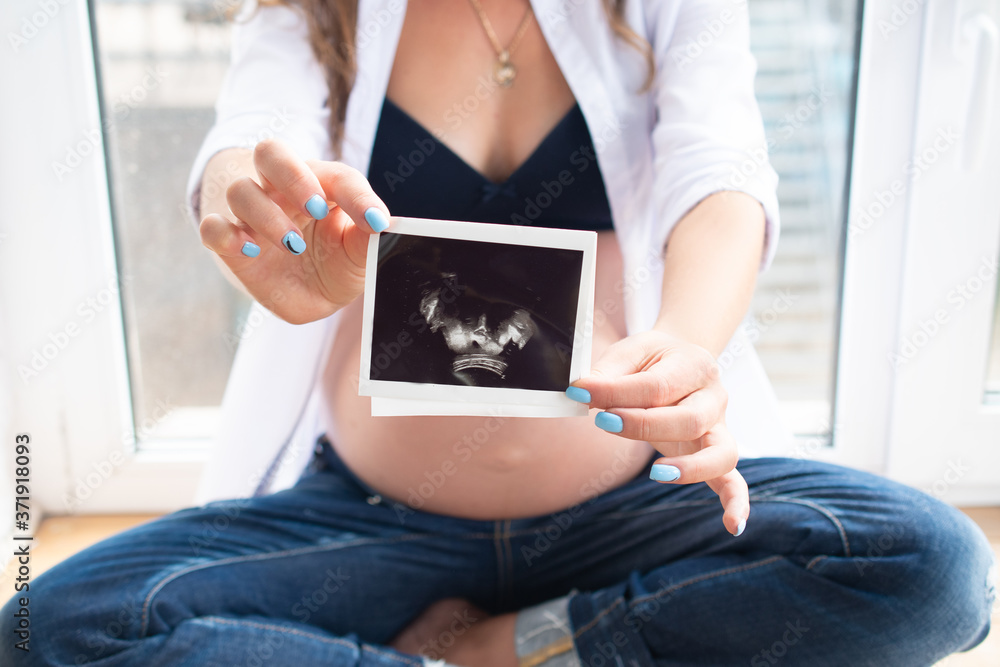 A pregnant woman holds an ultrasound image of her child: the concept of women's health A pregnant woman holds an ultrasound image of her child: the concept of women's health