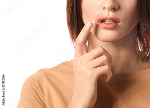 Foto Young woman with cold sore applying ointment on her lips against white backgroun