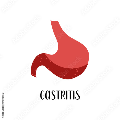 Gastritis. Stomach diseases. Gastroenterology. Vector flat illustration. Perfect for flyer, medical brochure, banner, landing page, website