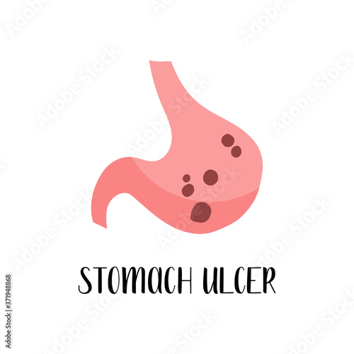 Stomach ulcer, gastric disease. Gastroenterology. Vector flat illustration. Perfect for flyer, medical brochure, banner, landing page, website