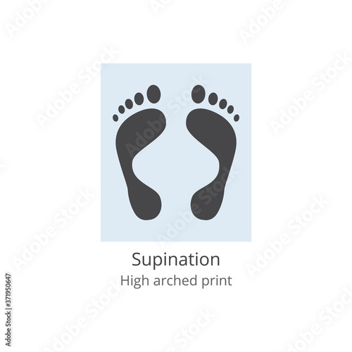 Supination - high arched print of human foot with medical deformity and leg anatomy problem