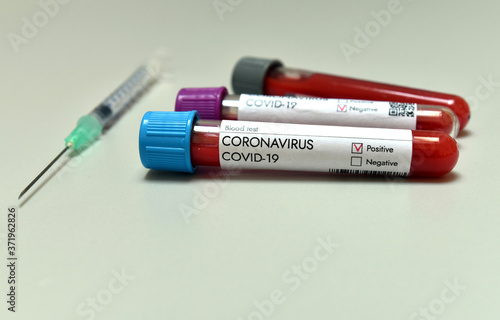 Coronavirus Covid 19 infected positive result blood test sample in research tube in laboratory where vaccine research is tested on Covid-19 