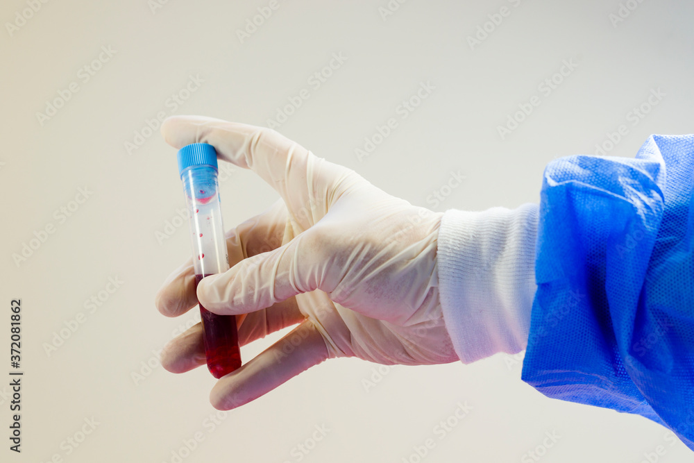 Chemical laboratory instruments, glassware and pipette. Tests and research diagnoses. Chemical laboratory instruments, glassware and pipette. Tests and research diagnoses.