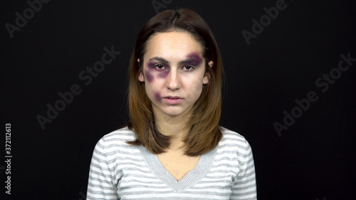 Young woman with bruises on her face. Quarrel in a young family. Domestic violence. On a black background.