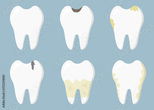 Dental diseases. Tooth decay, inflammation, dental plaque, periodontal disease. Concept of dentistry and medicine.