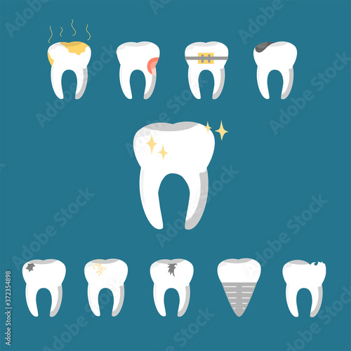 Cartoon Formation Dental Problems Set Health Care Tooth Concept Flat Design Style. Vector illustration.