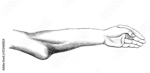 Broken handin the old book Diagnostik by Dr. Albert, Wien, 1900