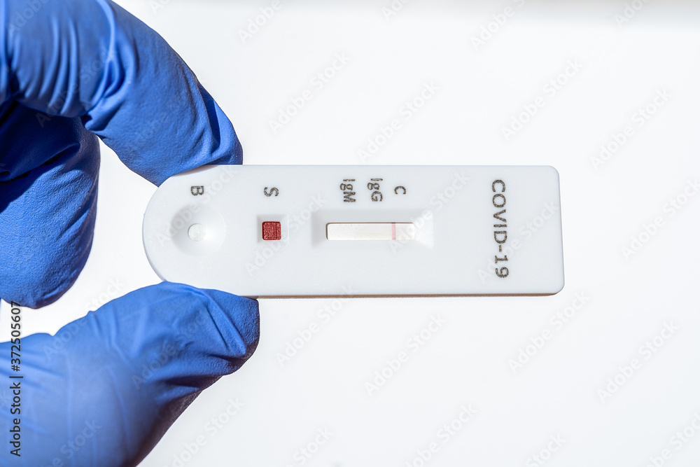 Rapid test to detect the disease caused by the coronavirus and if there are antibodies Rapid test to detect the disease caused by the coronavirus and if there are antibodies