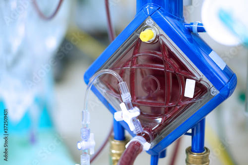 closeup oxygenator of ECMO (Extracorporeal membrane oxygenation) in critical care unit (CCU