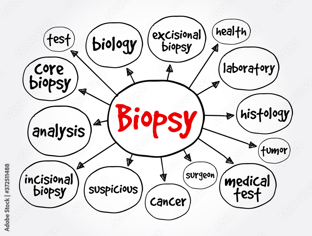 Biopsy mind map, medical concept for presentations and reports