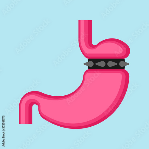 Stomach banding isolated. Adjustable Gastric Band. vector illustration