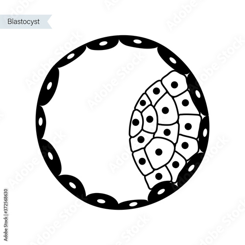 In vitro fertilisation concept