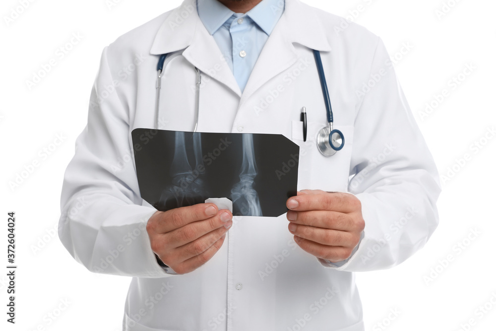 Orthopedist holding X-ray picture on white background, closeup