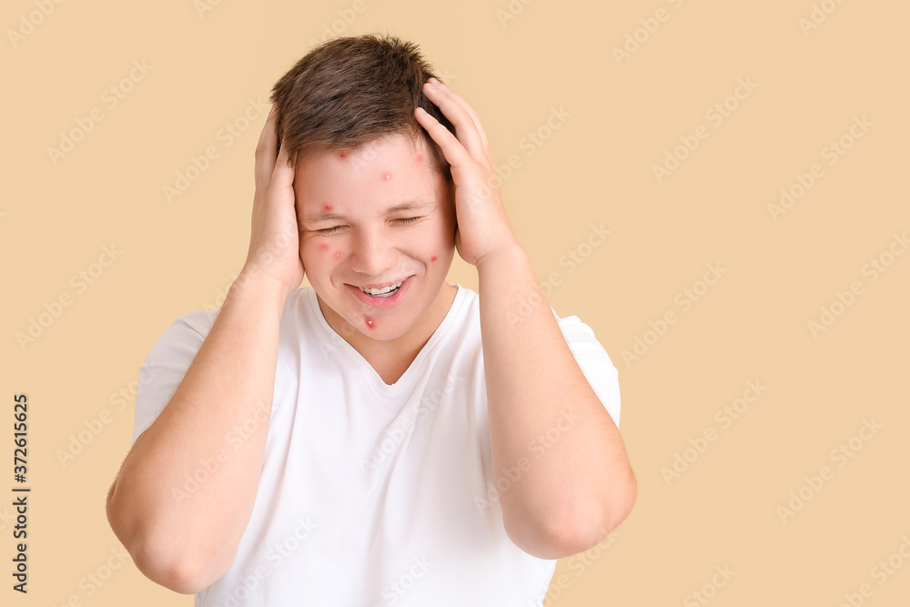 Stressed teenage boy with acne on color background Stressed teenage boy with acne on color background