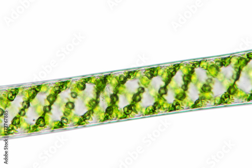 Microscopic close-up of Spirogyra algae under a microscope, ideal for biology research, education, and environmental studies