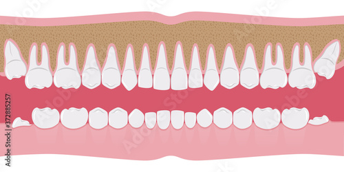 Healthy white human teeth in a row. Beautiful, even teeth with roots. The gums are cut to the bone. Structure of the jaw.Infographic elements for dentists and orthodontists.A flat-style banner. Vector