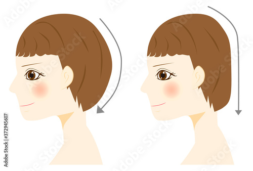 頭の形 　絶壁頭