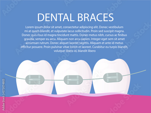 healthy white and straight teeth with braces. Dental care service - Orthodontic treatment and straightening of teeth. Flat vector illustration