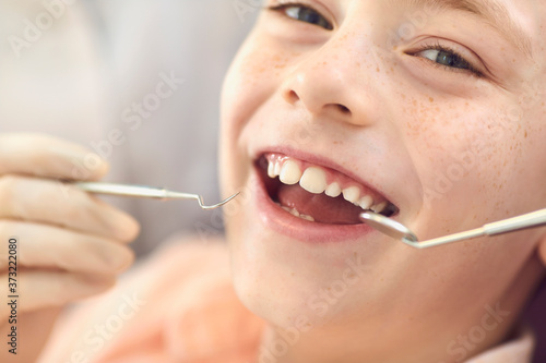 Close-up smiling child boy check-up in dentist office. Caries prevention and dental treatment.