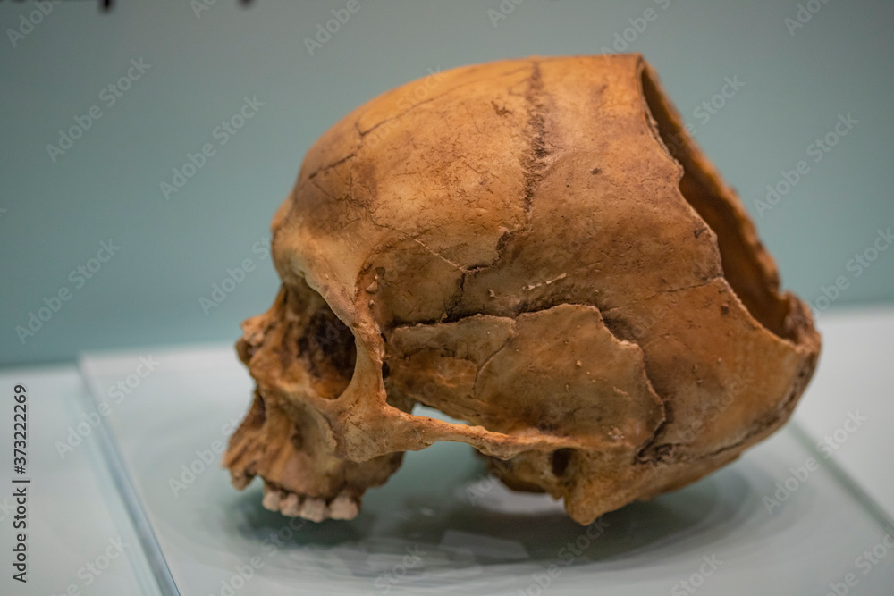 Plastic realistic skull model with damage. Anatomy. Tutorial. Plastic realistic skull model with damage. Anatomy. Tutorial.