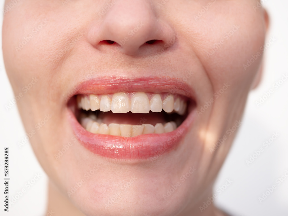 Middle aged woman laughs on white background showing perfect white teeth Middle aged woman laughs on white background showing perfect white teeth