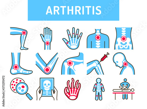 Arthritis human body line color icons set. Inflammation joints. Signs for web page, mobile app, button, logo. Editable stroke.