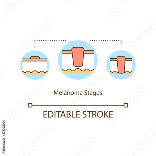 Melanoma stages concept icon. Dermatologist. Healthcare. Oncology risk factors. Skin cancer idea thin line illustration. Vector isolated outline RGB color drawing. Editable stroke