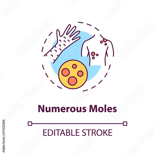 Numerous moles concept icon. Birthmarks. Human disease factors. Nevus treatment. Skin tags idea thin line illustration. Vector isolated outline RGB color drawing. Editable stroke