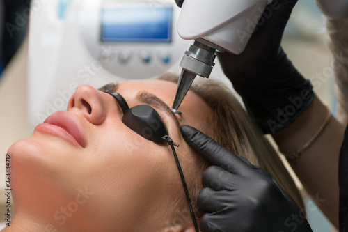 Laser removal of permanent makeup. The beautician removes the tattoo from the eyebrows.