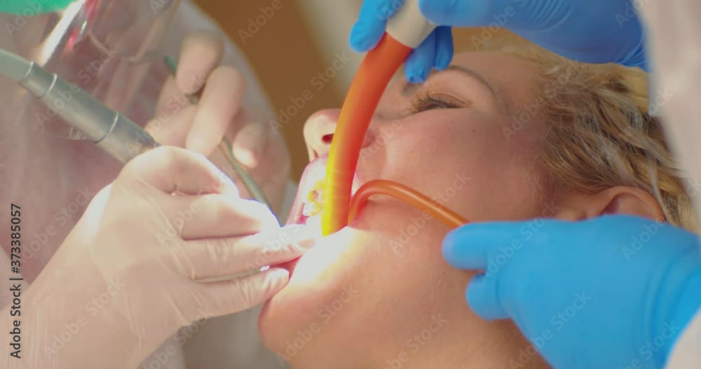 Close Up of Female Patient With Open Mouth in Dental Chair on Dentist Treatment. Gloves and Instruments in Doctor Hands Close Up of Female Patient With Open Mouth in Dental Chair on Dentist Treatment. Gloves and Instruments in Doctor Hands