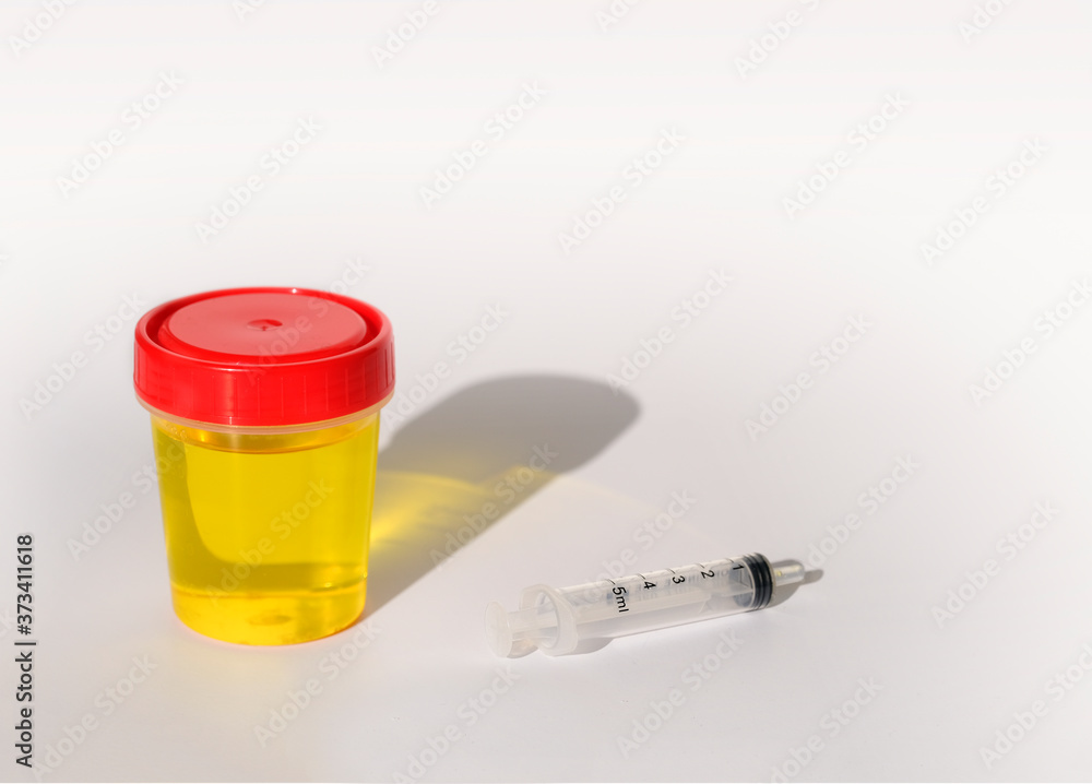 Urine test and syringe on white background. Urinalysis, Drug Testing
