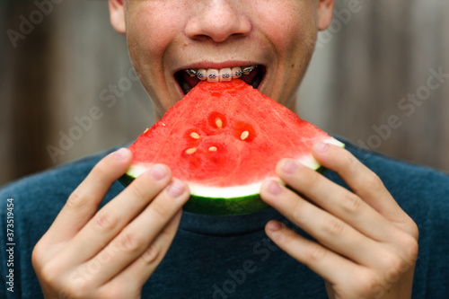 Teen boy with braces bites into watermelon photo