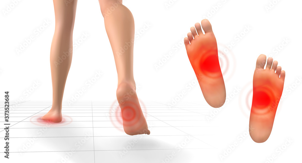 vector set of legs with red patches of pain on a white background vector set of legs with red patches of pain on a white background