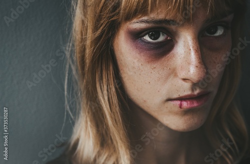 Stop violence against women