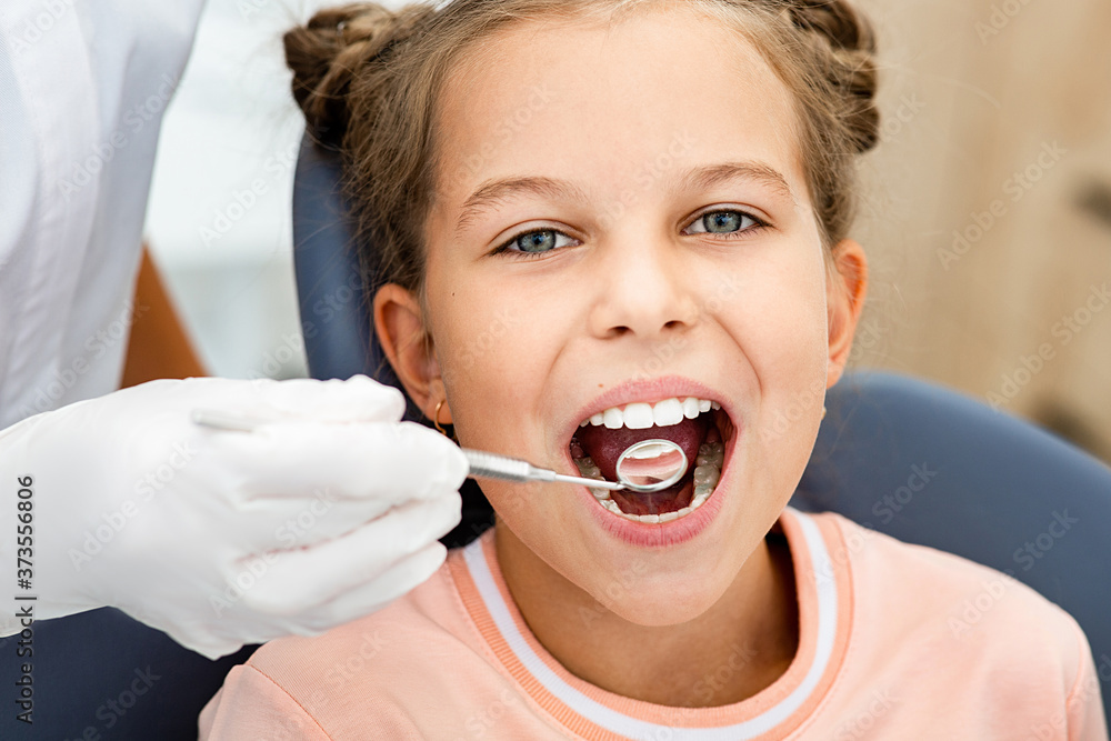 Little smiling girl, teeth check-up. Tooth exam using dental mirror close-up. Little smiling girl, teeth check-up. Tooth exam using dental mirror close-up.