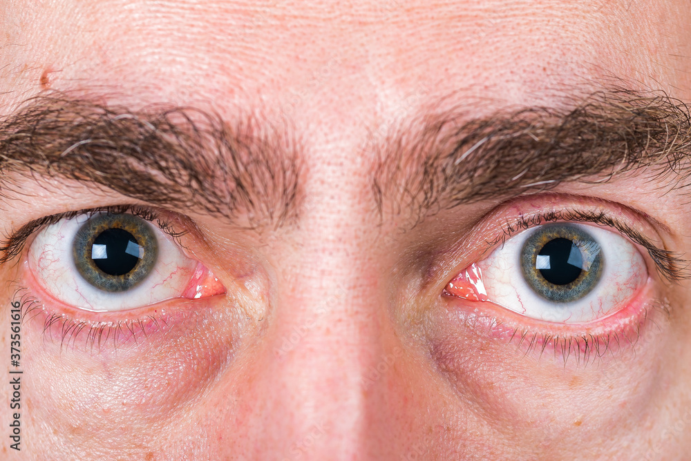 Fototapeta premium Big eyes of man with light skin and strong eyebrow and circles under eyes