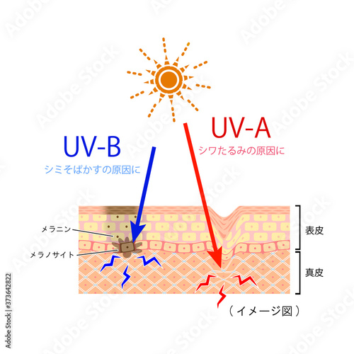  	紫外線　UV-A 　UV-B　（肌の断面図イメージ）
 photo