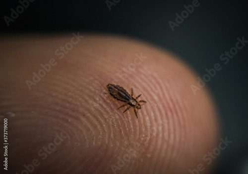 A Head Louse!
Adult lice are small flattened & entirely wingless. 
Abdomen is composed of seven visible segments, 6 legs, grayish white & about the size of a sesame seed. 