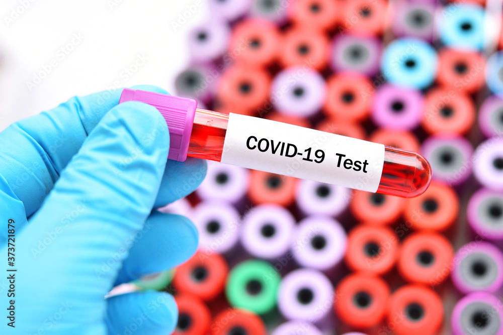 Obraz premium Test tube with blood sample for COVID-19 test, novel coronavirus pandemic disease in 2020