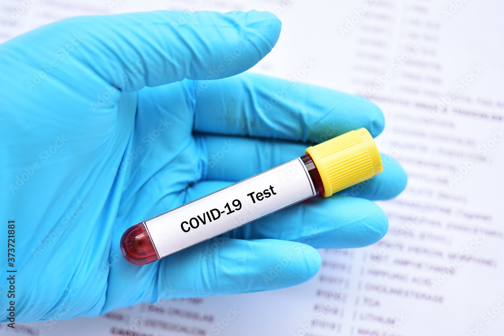 Fototapeta premium Test tube with blood sample for COVID-19 test, novel coronavirus pandemic disease in 2020