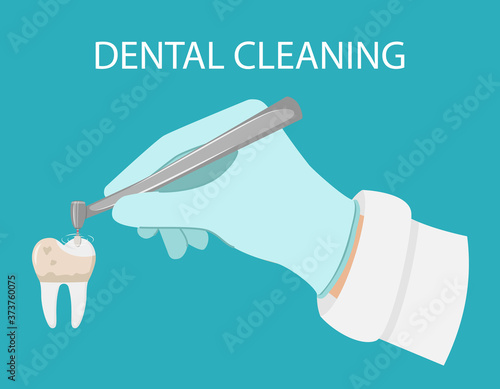 Dental cleaning of teeth. A gloved hand holds a dental polishing drill. Removal of Tartar and stains.Cleaning of dental calculus.Cosmetic and aesthetic dentistry. Open mouth. flat vector illustration.