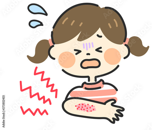 腕に湿疹ができた女の子