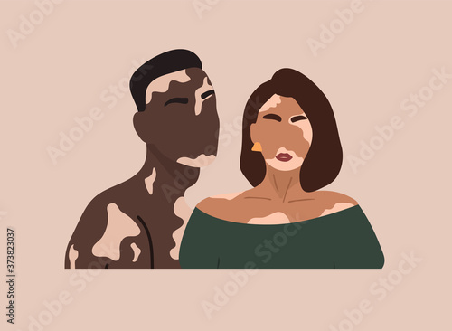Abstract couple silhouette with vitiligo of different nationalities standing together. Vector concept to support people living with vitiligo and to build awareness about chronic skin disorder.