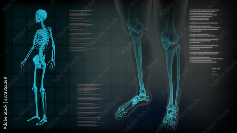 Vidéo Stock Set of 3 medical seamless looping clips for medical xray