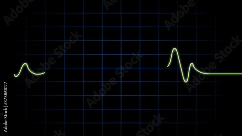 Pulse line graphich screen cardiology animation photo