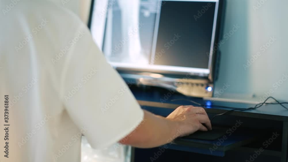 hand of a traumatologist uses a computer mouse, working with a computer