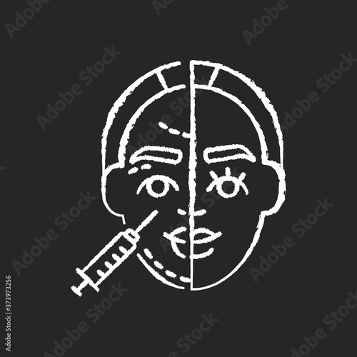 Skin injections chalk white icon on black background. Subcutaneous and whitening injections. Anti aging and wrinkle. Injectable dermal fillers. Isolated vector chalkboard illustration
