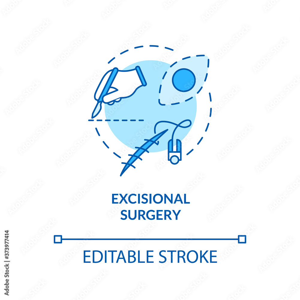 Excisional surgery concept icon. Skin lesions. Skin cancer treatment. Tumor removal. Excisional biopsy idea thin line illustration. Vector isolated outline RGB color drawing. Editable stroke Excisional surgery concept icon. Skin lesions. Skin cancer treatment. Tumor removal. Excisional biopsy idea thin line illustration. Vector isolated outline RGB color drawing. Editable stroke