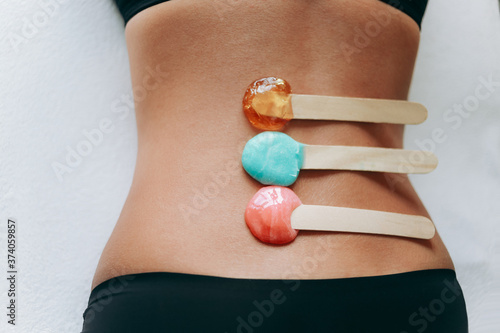 Closeup of female back covered sticks with hot wax and sugar paste for depilation hair removal procedure. The concept of depilation, epilation, waxing, shugaring.