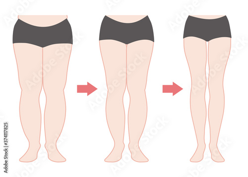 ダイエットの経過　脚やせ　カラー
